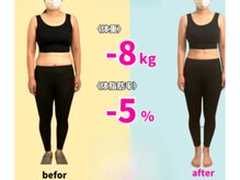 エムズ整体/40代腰痛・肩こり頭痛で無気力に