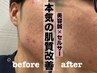 【人気No.2】セルサー+美容鍼（100本）で小顔・美肌・むくみ・肌質改善