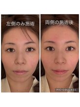 友愛はりきゅう美容整体院/ELコスメティック美容鍼