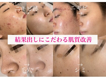 アテ 国分寺店(Ate)の写真