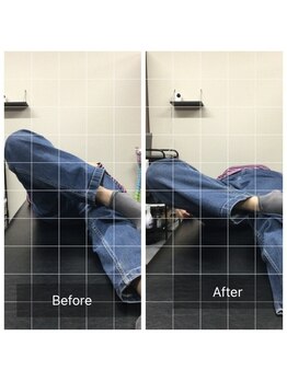 ナオル整体 センター南院(NAORU整体)/骨盤矯正後のBefore After