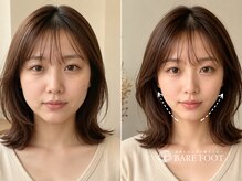 ベアフット(BARE FOOT)/３回で呼吸しやすい体へ