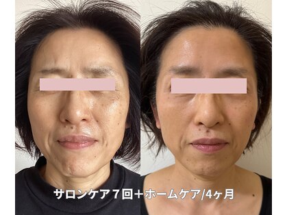 トリートメントルーム フェリーチェ(Felice)の写真
