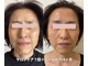 トリートメントルーム フェリーチェ(Felice)の写真