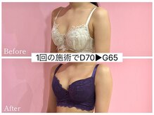 ククナ 新潟本店(KUKUNA)/＊バストアップケア＊
