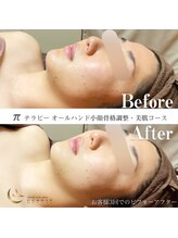 エスプリ 銀座店/本格小顔コルギ・オールハンド