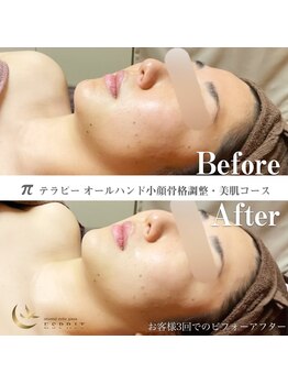 エスプリ 銀座店/本格小顔コルギ・オールハンド