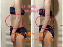 ヨサパーク シェリ 東戸塚(YOSA PARK Cheri)/感動のビフォーアフター♪