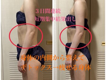 ヨサパーク シェリ 東戸塚(YOSA PARK Cheri)/感動のビフォーアフター♪