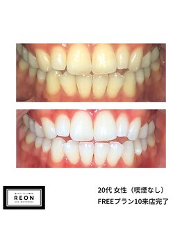 レオン 磐田(REON)/◇ お客様 before＆after ◇