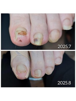 爪切り屋 足楽/