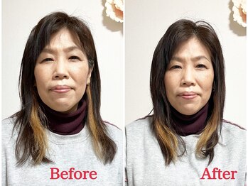 シルフィード/左右差が整いむくみもスッキリ