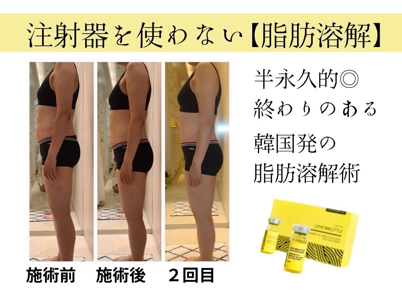 大阪市でエンダモロジーが人気のエステサロン｜ホットペッパービューティー