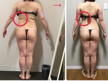 オージャス(OJAS)/40代○○様の変化　痩ボディーへ