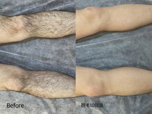 エリクサー 熊谷店(Elixir)/Before After