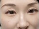 ニコプラス(nico+)の写真