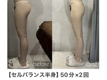 アーネスト 江坂店(EARNEST)/脚おしり集中ケア