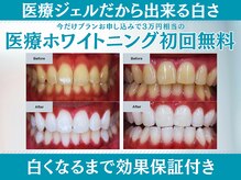 スマイルホワイト 赤羽店