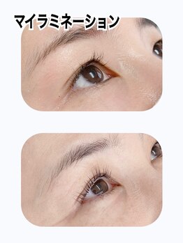 ファーストアイ(First eye)/マイラミネーション