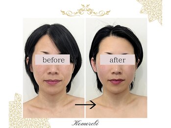 コモレビ(Komorebi)/