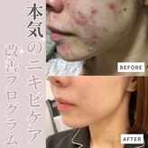 サロンドムーン(salon de MooN)