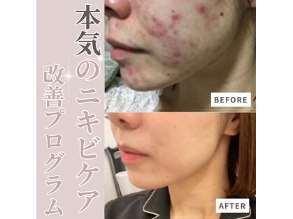 サロンドムーン(salon de MooN)の写真