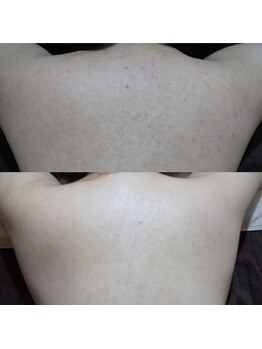 ザ シー タイムレスビューティ(THE SHE)/30代お客様症例写真