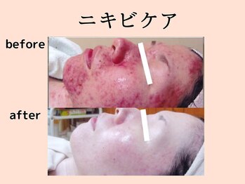 ウィズマツオカ 菊池本店/漢方エステ