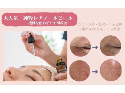 グロウスキン(GROW SKIN)の写真