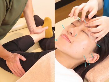 アカシア鍼灸整骨院の写真/目の疲れ、目がかすむ、目の奥が痛いとお悩みの方必見★パソコンやスマホ操作でお疲れの方に大好評！