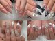 エヌネイル(n.nail)の写真/美フォルムな長さだしで自信の持てる指先に。自爪が短い方や形にコンプレックスがある方にも◎
