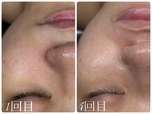 ビノスビューティー(vinos.beauty)/RELABEAUTEタラソトリートメント