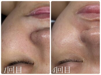 ビノスビューティー(vinos.beauty)/RELABEAUTEタラソトリートメント