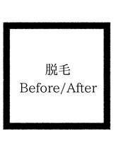 クリアボックス(Clear box)/【脱毛/キッズ脱毛/介護脱毛】