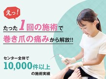 名古屋駅前巻き爪センター
