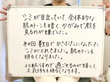 ポモナ 横浜馬車道店(Pomona)/シミケア美肌フェイシャル感想