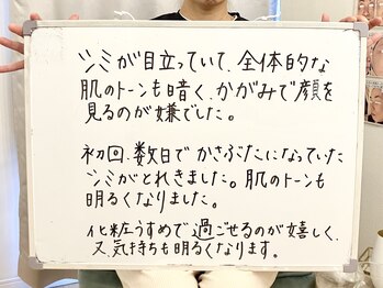 ポモナ 横浜馬車道店(Pomona)/シミケア美肌フェイシャル感想