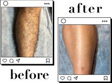 ホワイト(WHITE)/□Before～After〈脚〉