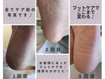 ネイル フライガール(nail FLY GIRL)/フットケア♪