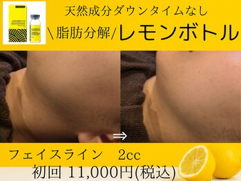 美々庵/レモンボトル/小顔/ブライダル