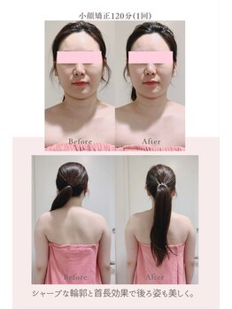 トゥインクル 麻布(twinkle)/港区/南麻布/白金/広尾/小顔矯正