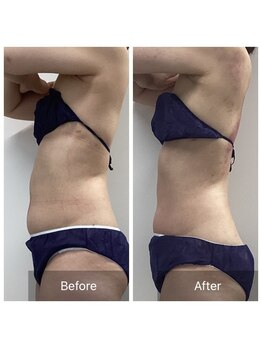 ダリア(Dahlia)/ぽっこりお腹もスッキリ