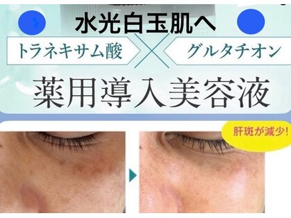 ルビーメイク(Ruby)の写真