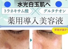 ルビーメイク(Ruby)