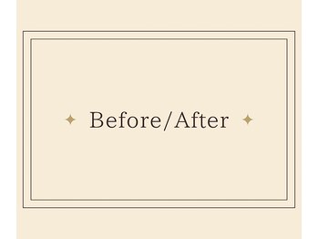 ヒーレンス(HEALENCE)/~Before After~