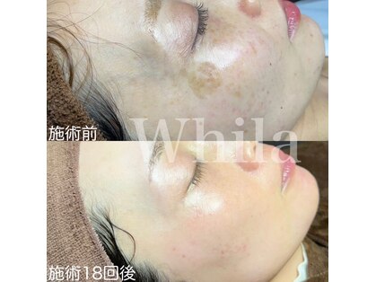 ホワラ 横浜店(Whila)の写真