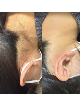 モンクラッシー(Mon classy)/