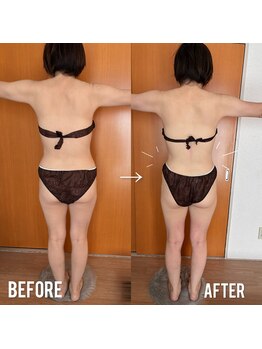 ヨサパーク ココロネ 大倉山(YOSA PARK kokorone)/たるまずダイエット! よもぎ蒸し