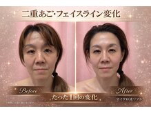 キャンディ 海老名駅前店(Candy)/海老名/フェイシャル/韓国肌管理