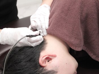 ダブルオー 銀座(00)の写真/【都度払い&勧誘なし/完全個室】美容電気脱毛★日焼け肌も気にせず脱毛◎うぶ毛・白髪も1本ずつアプローチ